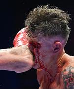 20 September 2024; (EDITORS NOTE: Image contains graphic content) Edward Donavan in action against Craig O'Brien in their Super Welterweight Celtic Title bout during a Boxing from Dublin event at the 3Arena in Dublin. Photo by David Fitzgerald/Sportsfile