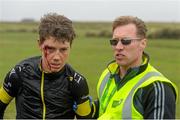 21 May 2015; Michael Cumming, left, JLT Condor, after a crash during Stage 5 of the 2015 An Post Rás. Newport - Ballina. Photo by Sportsfile