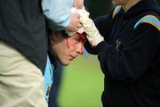 11 October 2008: UCD's Michael Hastings receives treatment for a head wound during the game. AIB League Division 1, UCD v Cork Constitution, Belfield Bowl, UCD, Dublin. Picture credit: Matt Browne / SPORTSFILE