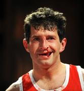 15 November 2008; Enda Murphy, Leixlip GAA Club, after being defeated by Mick Foley, Athy. Kildare GAA Fight Night, Time: bar + venue, Naas, Co. Kildare. Picture credit: Ray Lohan / SPORTSFILE  *** Local Caption ***